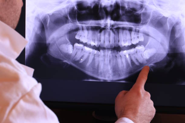 Best Emergency Denture Repair in Rocky Point, NY