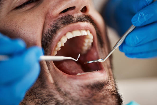 Best Pediatric Emergency Dentist in Rocky Point, NY